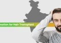 Hair Transplant in India